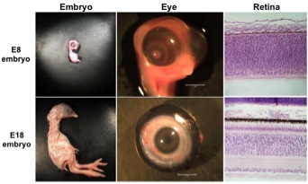 Enke eye research