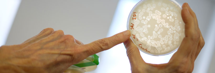 Microphage petri dish