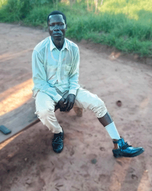A man sits on a bench with one pant leg rolled up showing his prosthetic foot in a shoe.