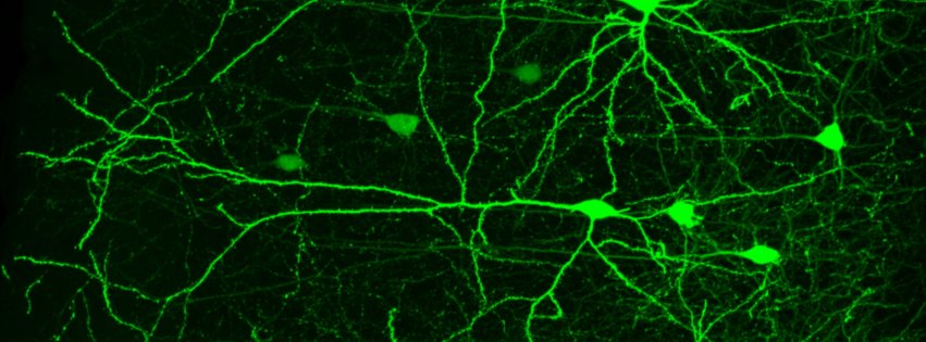 fluorescence microscope image of mouse neurons