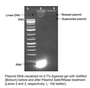 image from microscope of plasmid DNA bands