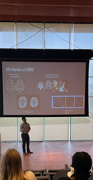 McFarlane presents information to a small crowd. The presentation on the projector shows brain scans and says "MRI Markers or ADRD."