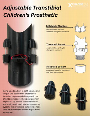 Engineering prosthesis info
